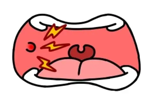 マウスピースと口内炎！？🥵