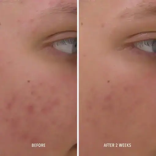 HydroPeptide Clear Rescue Serum