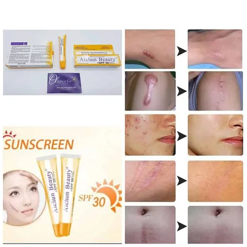 Crème anti-cicatrices Aichun Beauty SPF 30 – Image 5