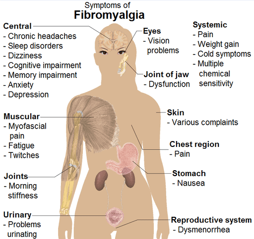 Fibromyalgia Symptoms