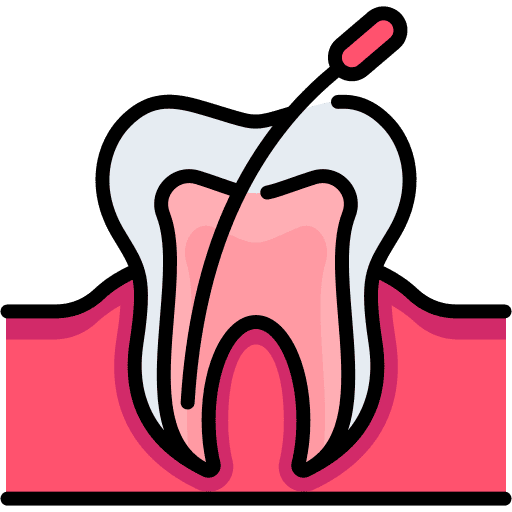 Root Canal Treatment