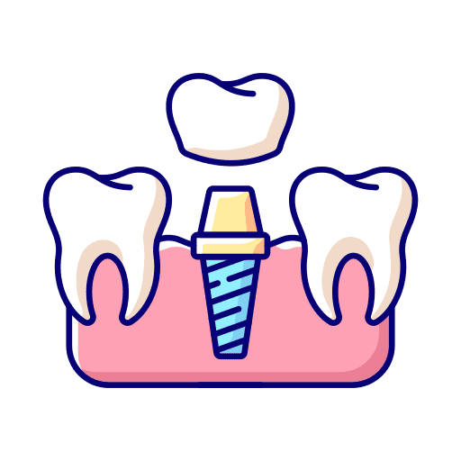Dental Implants