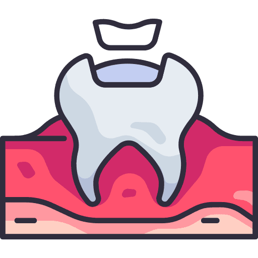 Teeth Filling & Restoration
