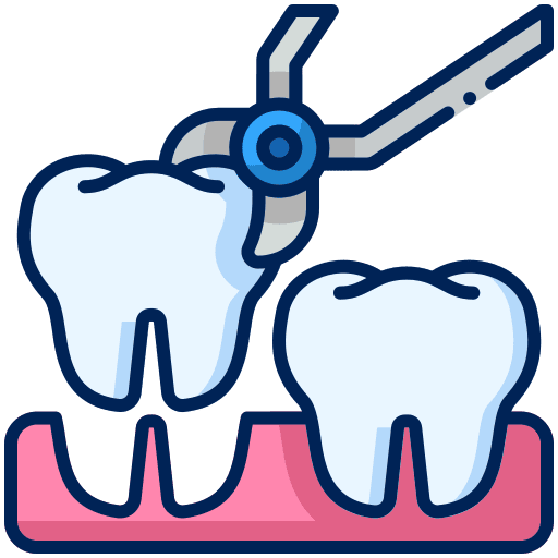 Tooth Extraction