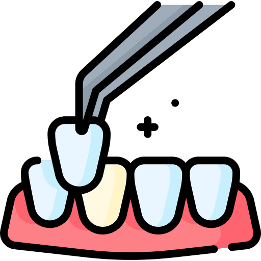 Dental Veneers & Smile Makeover