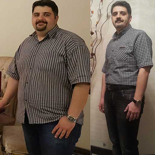 بهترین روش لاغری