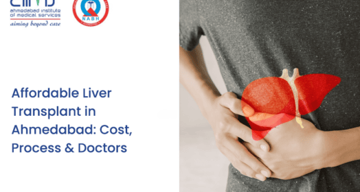 Affordable Liver Transplant in Ahmedabad