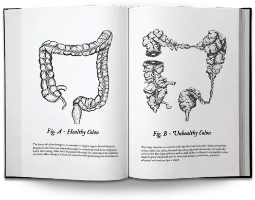 colon-image