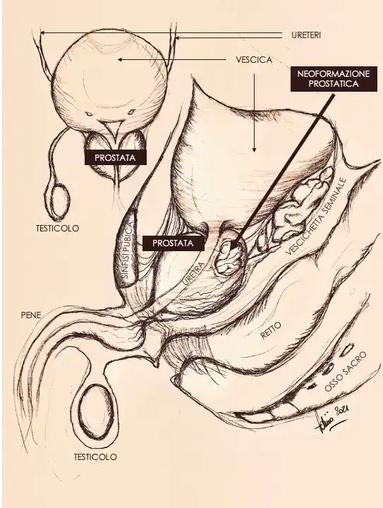 La prostata tra curiosità e storia