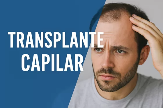 Transplante Capilar: O Procedimento que Revolucionou o Tratamento da Calvície