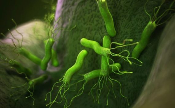Бактерия Хеликобактер пилори (Helicobacter pylori)