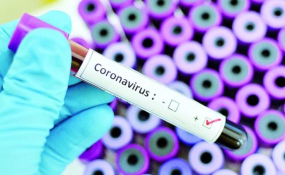 Инкубационный период коронавируса COVID-19 составляет 5 - 6 дней