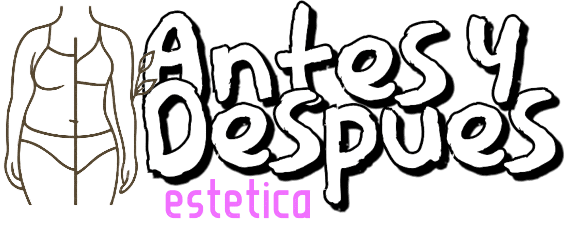 Antes y Despues Estetica
