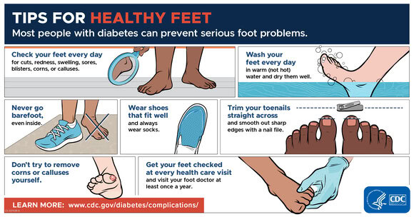 Infographic from the CDC that explains how you can keep your feet healthy if you have diabetes.