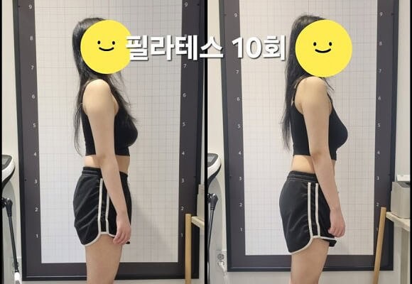 경기 광주 필라테스 허리통증