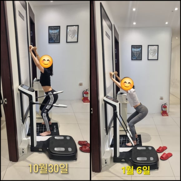 경기광주 어깨재활필라테스