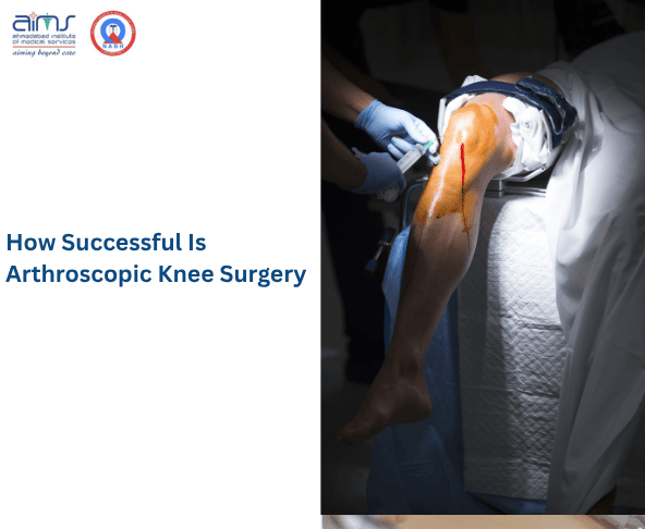 Arthroscopic Knee Surgery