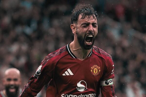 Burnley – Man United