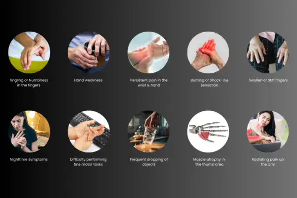 10 warning signs of carpal tunnel syndrome you shouldn’t ignore
