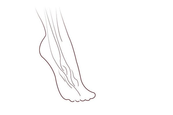 Drop Foot Surgery (Tendon Transfer)