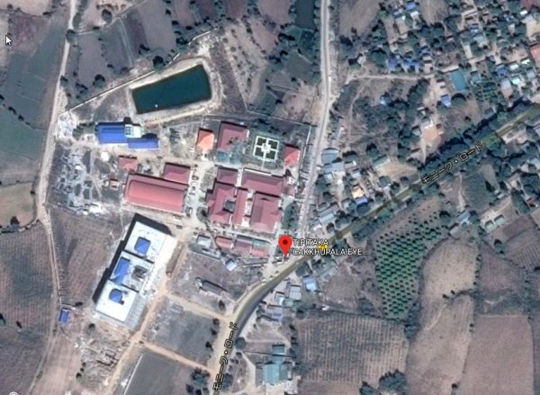 Shwe Yatu Tipitaka Cakkhupala Eye Hospital