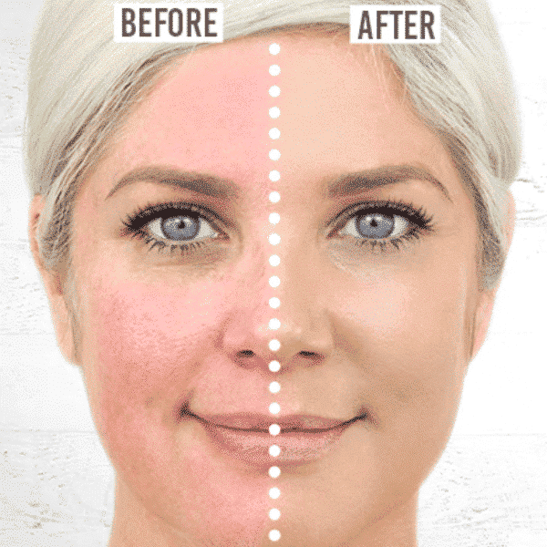Rosalique 3 in 1 Anti-Redness Miracle Formula SPF50 – afbeelding 2