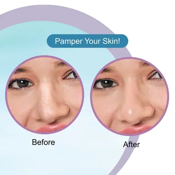 Dr. Rashel Hyaluronic Acid Nose Pore Cleansing Strips (10 Strips) – Hydrating Blackhead & Impurity Remover {Pack of 2} - Image 8