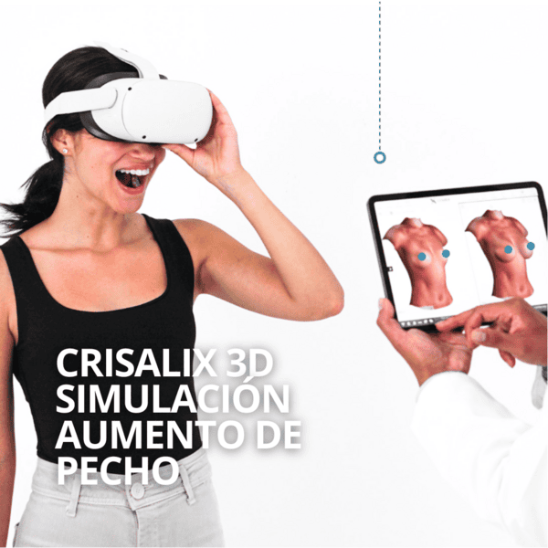 Aumento de Pecho simulación Crisalix 3d