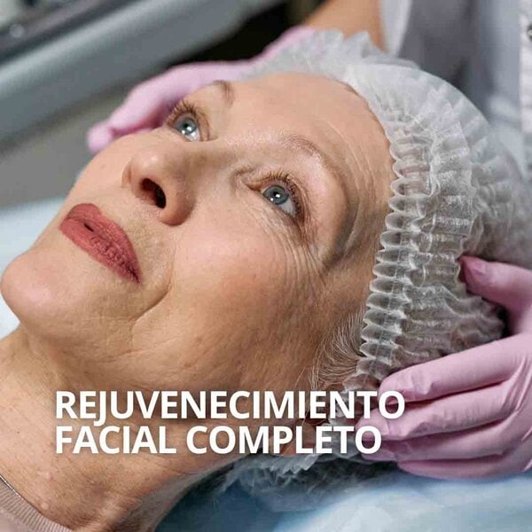 Rejuvenecimiento facial completo Sevilla
