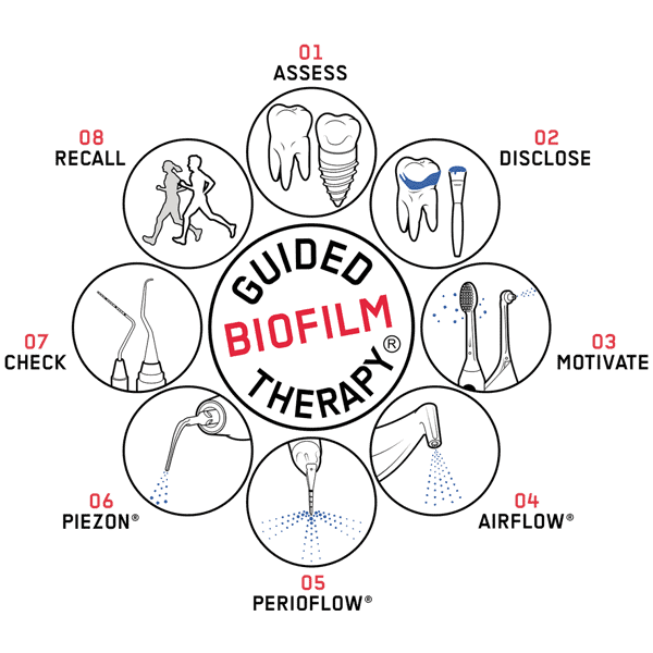 Teeth Cleaning - Guided Biofilm Therapy Process
