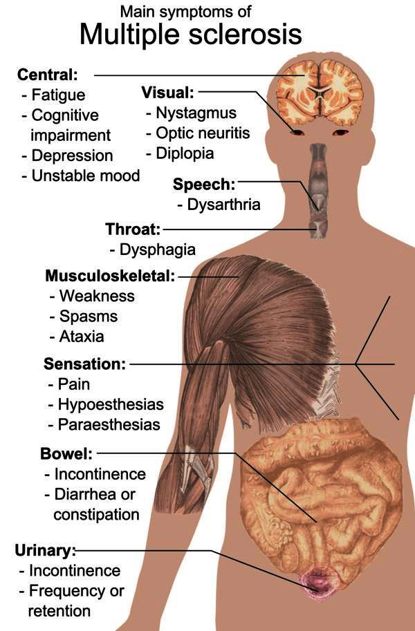 Main MS Symptoms