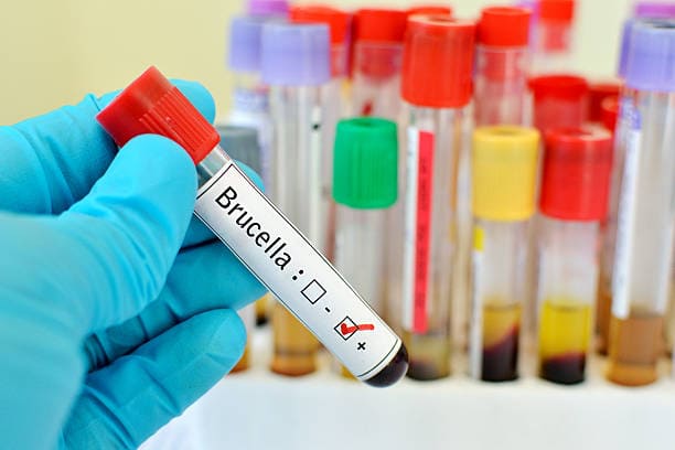 Peynirin hastalığı Brucella