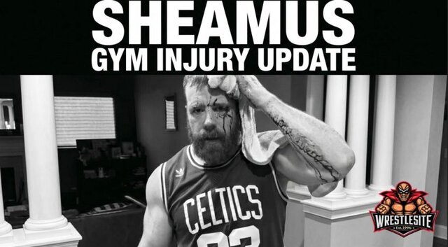 Sheamus Suffers Head Wound In Gym Accident