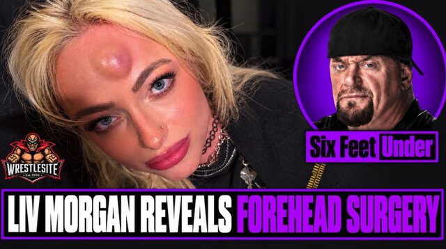 Liv Morgan Reveals Forehead Surgery