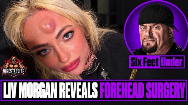 Liv Morgan Reveals Forehead Surgery