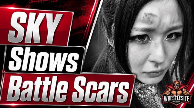 IYO SKY Reveals Bruising After Raw Attack