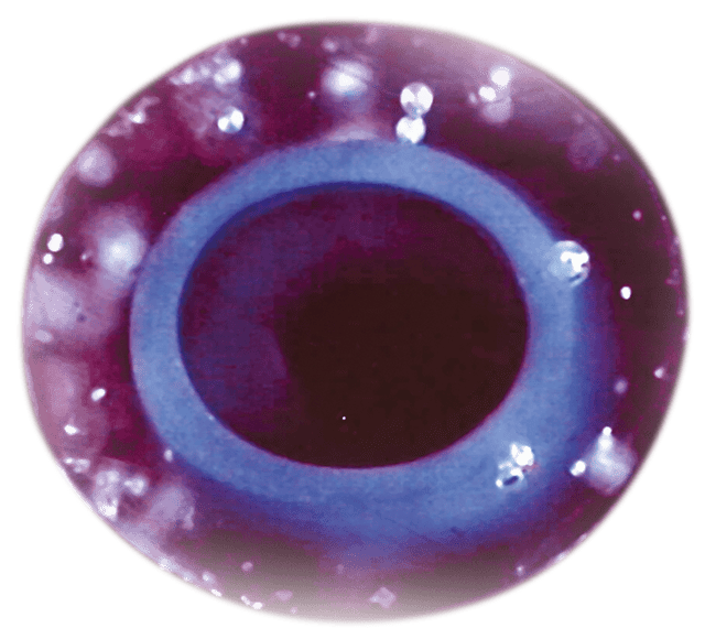 Embryo Transfer - CooperSurgical