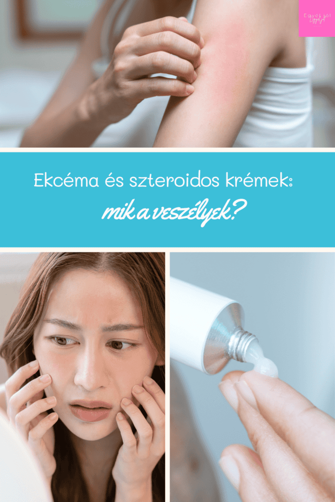 Ekcéma és szteroidos krémek: mik a veszélyek és van-e jobb megoldás?