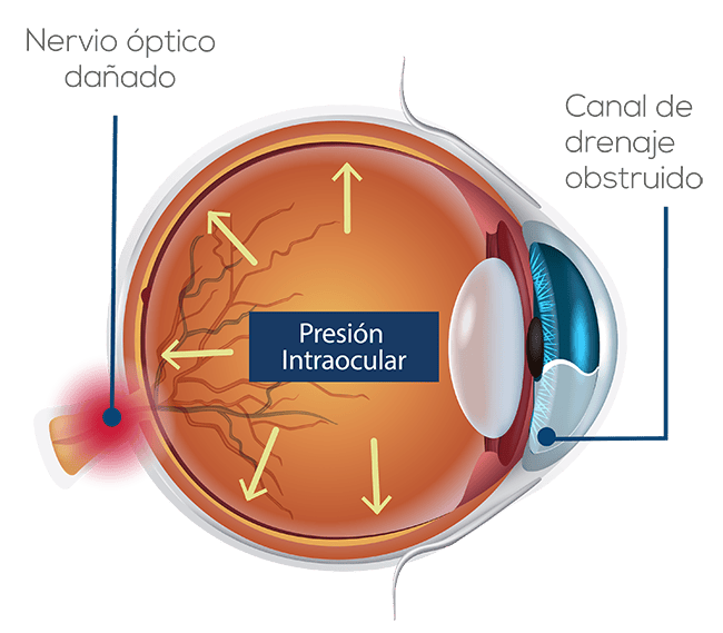 servicios clínica visualiza Guatemala oftalmología