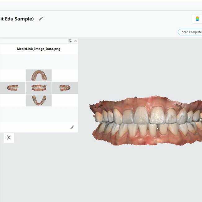 Simulation 3D d'orthodontie