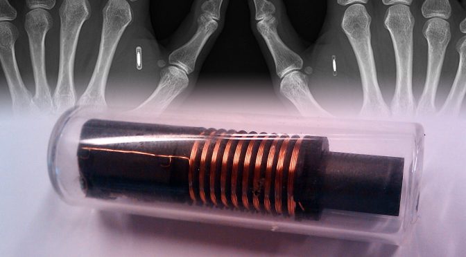 Biohacking: Würden Sie sich einen Chip implantieren lassen?