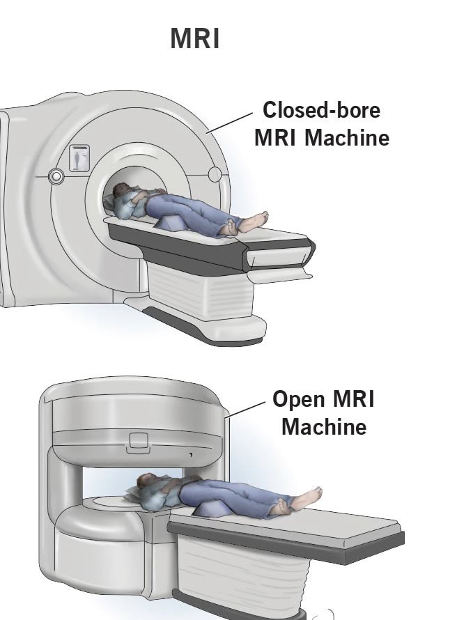 Open mri vs closed mri