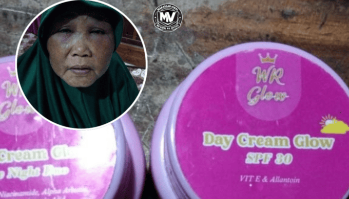 Warga Gowa Diduga Jadi Korban Skincare Berbahaya, Usai Pakai WR Glow Wajah Gatal dan Bengkak