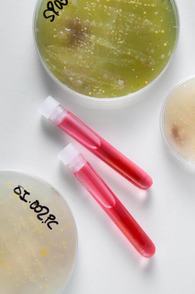 candidates-for-ez-prf-ez-gel