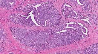 Anatomia microscopica della prostata