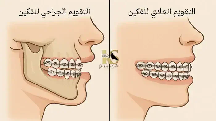 الفرق بين التقويم الجراحي والتقويم العادي للفكين