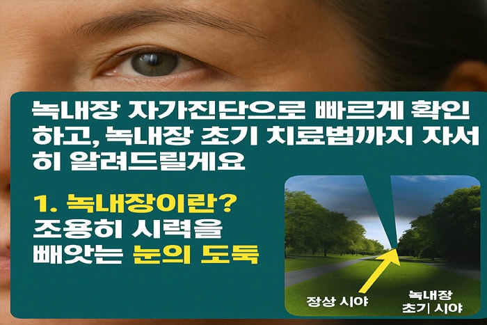 녹내장이란 조용히 시력을 빼앗는 눈의 도둑