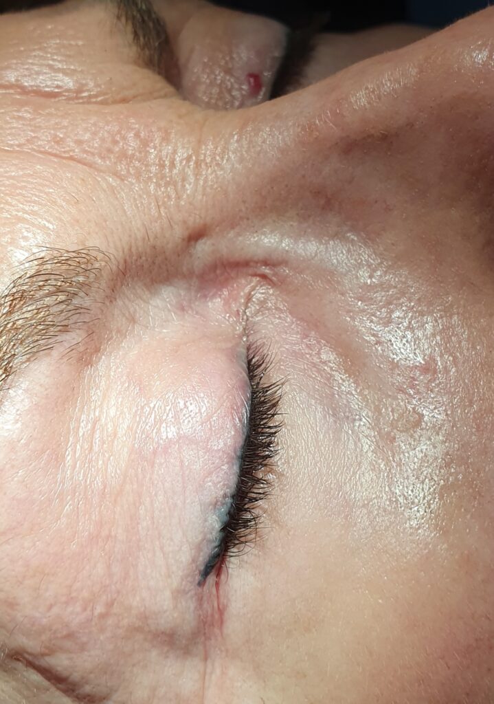 Corrección micropigmentación ojos
