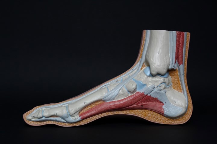 HEEL PAIN TREATMENT (NON-SURGICAL) - Your Feet Support Your Health Infinity Foot and Ankle -