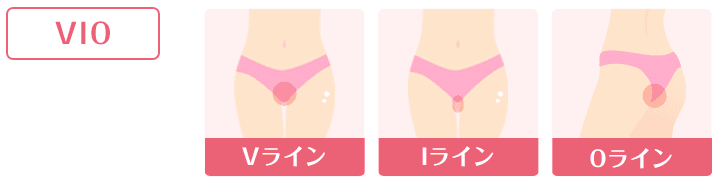 VIO脱毛の照射範囲